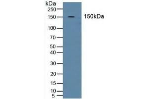 Detection of BND3 in Human Blood Cells using Polyclonal Antibody to Band 3 (BND3) (Band 3/AE1 antibody  (AA 35-290))