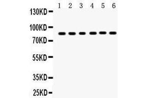 Anti-TPA Picoband antibody, Western blotting All lanes: Anti TPA  at 0. (PLAT antibody  (AA 366-562))