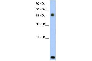 WB Suggested Anti-RSAD2 Antibody Titration:  2. (RSAD2 antibody  (N-Term))