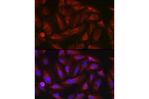 Immunofluorescence analysis of U-2 OS cells using ErbB4/HER4 Rabbit pAb (ABIN6131263, ABIN6140257, ABIN6140260 and ABIN6221732) at dilution of 1:100 (40x lens). (ERBB4 antibody  (AA 26-160))