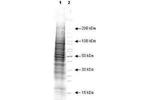 Coommassie stained SDS-PAGE of 20 ? (A431 Whole Cell Lysate (EGF Stimulated))