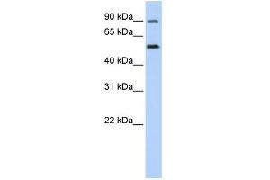 WB Suggested Anti-SLC41A1 Antibody Titration:  0.