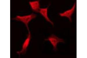 ABIN6275423 staining Hela by IF/ICC. (PLEKHG4 antibody  (Internal Region))