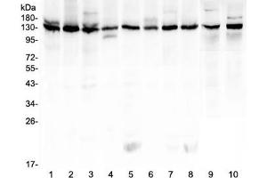 Western blot testing of human 1) K562, 2) HeLa, 3) 293T, 4) A431, 5) Caco-2, 6) PC-3, 7) MCF7, 8) U-2 OS, 9) rat testis and 10) mouse testis lysate with Bub1 antibody at 0. (BUB1 antibody  (AA 731-1085))