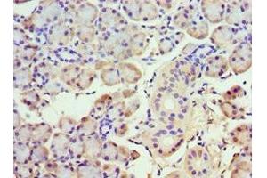 Immunohistochemistry of paraffin-embedded human pancreatic tissue using ABIN7142031 at dilution of 1:100 (ABHD5 antibody  (AA 1-349))