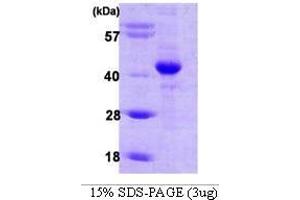 Figure annotation denotes ug of protein loaded and % gel used. (HIF1AN Protein (AA 1-349))