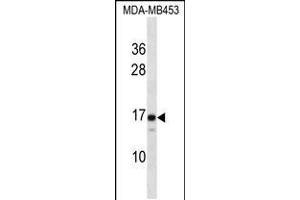 Western blot analysis in MDA-MB453 cell line lysates (35ug/lane). (LIM2 antibody  (C-Term))