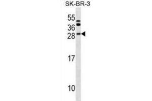Western Blotting (WB) image for anti-B-Cell CLL/lymphoma 7C (BCL7C) antibody (ABIN2999905)