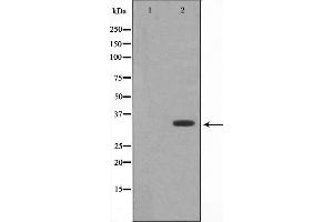 Western blot analysis of DARPP-32 expression in EGF treated 293 whole cell lysates,The lane on the left is treated with the antigen-specific peptide.