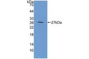Detection of Recombinant GP39, Mouse using Polyclonal Antibody to Chitinase-3-like Protein 1 (CHI3L1) (CHI3L1 antibody  (AA 112-356))