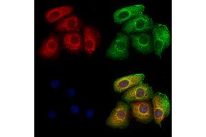 ABIN6266053 and ABIN6273349 staining Hela cells by IF/ICC.