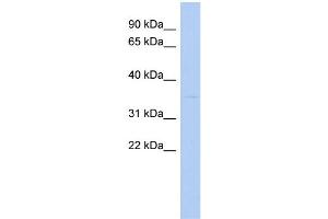 WB Suggested Anti-STUB1 Antibody Titration:  0. (STUB1 antibody  (N-Term))