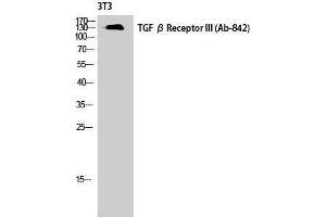 Western Blotting (WB) image for anti-Transforming Growth Factor, beta Receptor III (TGFBR3) (Tyr160) antibody (ABIN3180916) (TGFBR3 antibody  (Tyr160))