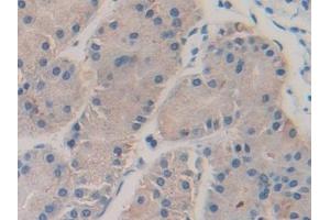 Detection of F5 in Human Stomach Tissue using Polyclonal Antibody to Coagulation Factor V (F5)