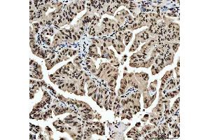 IHC analysis of HNRNPL using anti-HNRNPL antibody (ABIN4886624). (HNRNPL antibody  (C-Term))