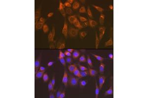 Immunofluorescence analysis of NIH-3T3 cells using Sec23AA Rabbit mAb (ABIN7270168) at dilution of 1:100 (40x lens). (SEC23A antibody)