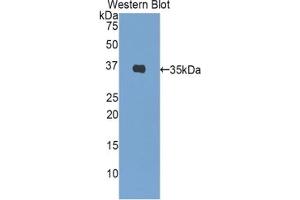 Detection of Recombinant INS, Porcine using Polyclonal Antibody to Insulin (INS) (Insulin antibody  (AA 88-108))