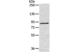 Western blot analysis of 231 cell, using RPS6KA1 Polyclonal Antibody at dilution of 1:800 (RPS6KA1 antibody)