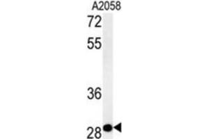 Western Blotting (WB) image for anti-Chromosome 11 Open Reading Frame 46 (C11orf46) antibody (ABIN2995509) (C11orf46 antibody)