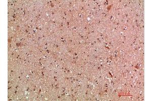 Immunohistochemistry (IHC) image for anti-Myeloid/lymphoid Or Mixed-Lineage Leukemia (MLL) (AA 3850-3900) antibody (ABIN7189494)