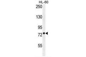 CPT1C Antibody (C-term) western blot analysis in HL-60 cell line lysates (35µg/lane).