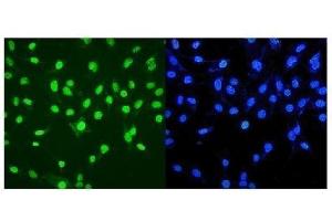 IF analysis of MTA2 using anti-MTA2 antibody (ABIN7599519). (MTA2 antibody  (AA 1-668))