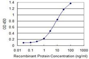 Detection limit for recombinant GST tagged HSFY1 is 0. (HSFY1 antibody  (AA 1-99))