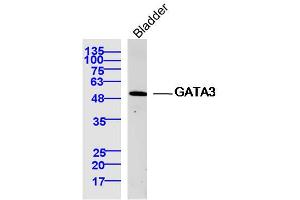 Mouse bladder lysates probed with GATA3 Polyclonal Antibody, Unconjugated  at 1:300 dilution and 4˚C overnight incubation.