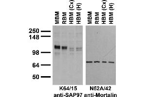 Immunoblots on brain membranes prepares from whole rat (RBM) and mouse (MBM) brain, and from human cerebral cortex [HBM(Cx)], and hippocampus [HBM(H)]