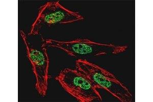 Fluorescent confocal image of HeLa cell stained with MyoD1 antibody at 1:25. (MYOD1 antibody  (AA 211-240))
