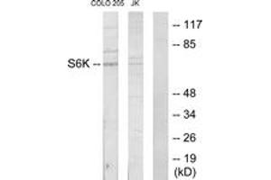 Western blot analysis of extracts from COLO205/Jurkat cells, using S6K Antibody. (RPS6KB1 antibody  (AA 261-310))