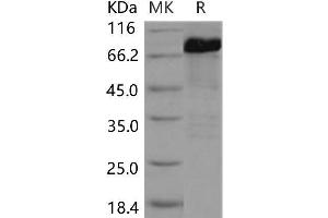 SMAD5 Protein (GST tag,His tag)