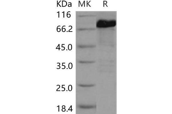 SMAD5 Protein (GST tag,His tag)