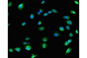 Immunofluorescent analysis of U251 cells using ABIN7148217 at dilution of 1:100 and Alexa Fluor 488-congugated AffiniPure Goat Anti-Rabbit IgG(H+L) (COL8A1 antibody  (AA 572-744))