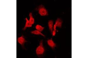 ABIN6269025 staining sw480 by IF/ICC. (KRT16 antibody  (C-Term))