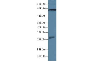 Detection of CAMK2g in Rat Cerebrum lysate using Polyclonal Antibody to Calcium/Calmodulin Dependent Protein Kinase II Gamma (CAMK2g) (CAMKII gamma antibody  (AA 6-208))