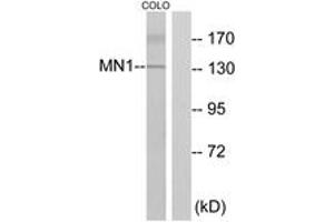 Western blot analysis of extracts from COLO cells, using MN1 Antibody.