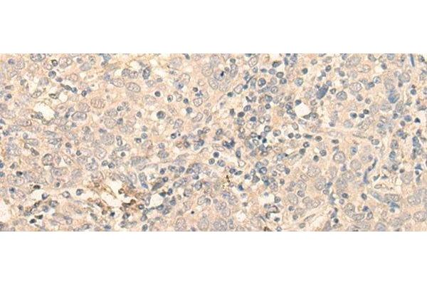 PNKD antibody