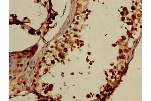 Immunohistochemistry of paraffin-embedded human testis tissue using ABIN7151564 at dilution of 1:100 (ELOVL4 antibody  (AA 270-314))