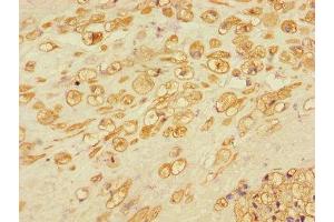 Immunohistochemistry of paraffin-embedded human placental tissue using ABIN7150164 at dilution of 1:100 (Retinoblastoma Binding Protein 8 antibody  (AA 126-331))