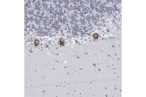 Immunohistochemical staining of human cerebellum with FAM207A polyclonal antibody  shows strong cytoplasmic positivity(granular pattern) in Purkinje cells at 1:200-1:500 dilution. (FAM207A antibody)