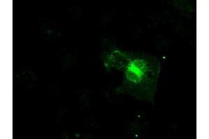 Image no. 9 for anti-Fc gamma RII (CD32) antibody (ABIN1497256) (Fc gamma RII (CD32) antibody)