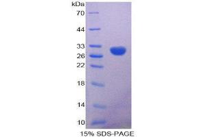 SDS-PAGE (SDS) image for Calbindin 2 (CALB2) (AA 28-248) protein (His tag) (ABIN2124222)