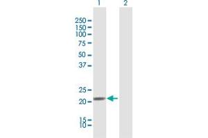 Western Blot analysis of IFNA21 expression in transfected 293T cell line by IFNA21 MaxPab polyclonal antibody. (IFNA21 antibody  (AA 1-189))