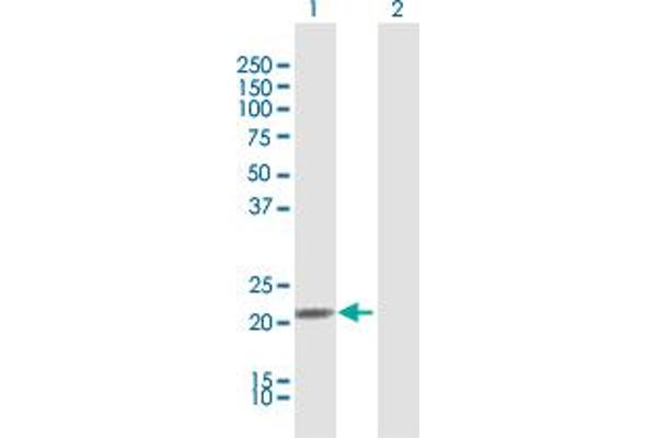 IFNA21 anticorps  (AA 1-189)