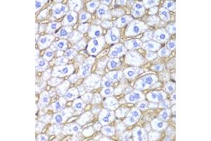 Immunohistochemistry of paraffin-embedded mouse liver using HLA-A antibody at dilution of 1:100 (400x lens). (HLA-A antibody)