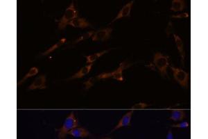 Immunofluorescence analysis of C6 cells using RPL7A Polyclonal Antibody at dilution of 1:100 (40x lens). (RPL7A antibody)