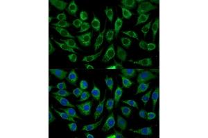 Immunofluorescence analysis of L929 cells using  Polyclonal Antibody (ABIN7266299) at dilution of 1:100 (40x lens). (CCL17 antibody  (AA 420-500))