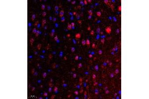 Immunofluorescence of paraffin embedded mouse brain using UBE3A (ABIN7076105) at dilution of 1:650 (400x lens) (ube3a antibody)