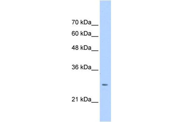 Aspartate beta Hydroxylase antibody  (N-Term)